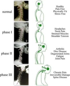 texarkana chiropractor helps arthritis pain, stiffness, and muscle spasms