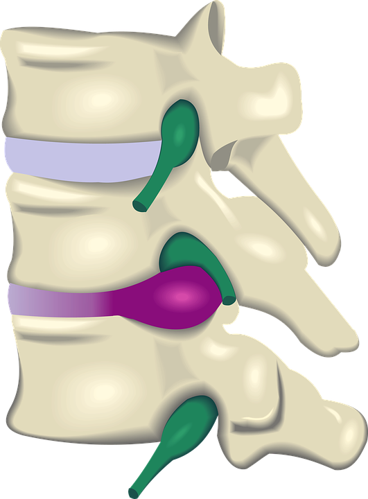 chiropractic pain relief from pinched nerve in the back